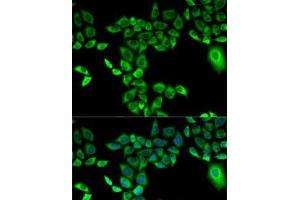 Immunofluorescence analysis of A-549 cells using FMO3 Polyclonal Antibody (FMO3 抗体)