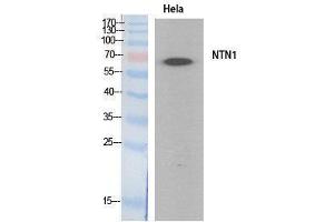Western Blotting (WB) image for anti-Netrin 1 (NTN1) (Internal Region) antibody (ABIN3178538) (Netrin 1 抗体  (Internal Region))
