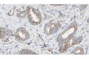ABIN6268954 at 1/100 staining Human prostate tissue by IHC-P. (EIF4B 抗体  (Internal Region))