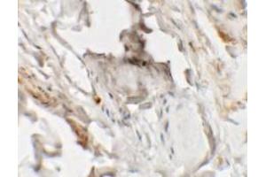 Immunohistochemistry (IHC) image for anti-Hedgehog Acyltransferase-Like (HHATL) (N-Term) antibody (ABIN1031403) (HHATL 抗体  (N-Term))