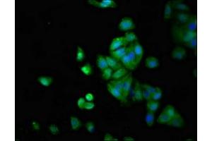 Immunofluorescence staining of HepG2 cells with ABIN7158287 at 1:66, counter-stained with DAPI. (LTK 抗体  (AA 20-175))
