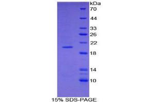 SDS-PAGE analysis of Mouse COL3A1 Protein. (COL3A1 蛋白)