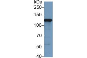 Western Blot; Sample: Human HepG2 cell lysate; Primary Ab: 1µg/ml Rabbit Anti-Human HK2 Antibody Second Ab: 0. (Hexokinase 2 抗体  (AA 619-917))