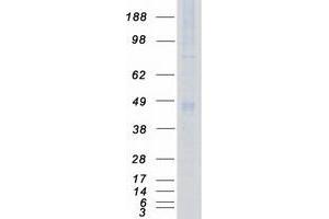 Western Blotting (WB) image for 3-phosphoinositide Dependent Protein Kinase-1 (PDPK1) (Transcript Variant 2) protein (Myc-DYKDDDDK Tag) (ABIN2728602)