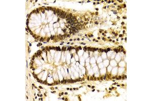 Immunohistochemistry (IHC) image for anti-Karyopherin (Importin) alpha 4 (KPNA4) (AA 1-240) antibody (ABIN3015855)