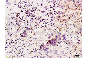 Immunohistochemistry (IHC) image for anti-Colony Stimulating Factor 3 (Granulocyte) (CSF3) (AA 155-198) antibody (ABIN736521) (G-CSF 抗体  (AA 155-198))