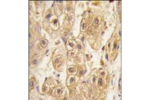 Image no. 2 for anti-Platelet Derived Growth Factor Receptor beta (PDGFRB) antibody (ABIN359922) (PDGFRB 抗体)