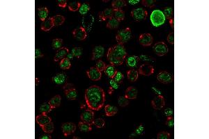 Immunofluorescence (IF) image for anti-Neurofilament, Heavy Polypeptide (NEFH) antibody (ABIN6940180)
