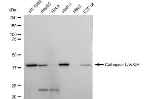 Western blotting analysis using Cathepsin L/V/K/H antibody (ABIN7797941).