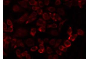 ABIN6274737 staining HuvEc by IF/ICC. (MRPL24 抗体  (Internal Region))