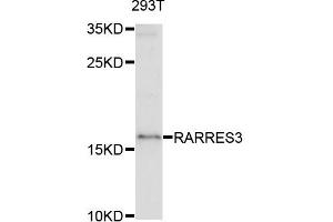 Western blot analysis of extracts of 293T cells, using RARRES3 antibody. (RARRES3 抗体)