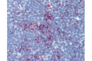 Anti-SENP1 antibody IHC of human thymus. (SENP1 抗体  (AA 28-59))