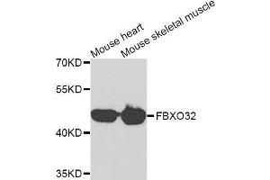 Western blot analysis of extracts of mouse heart and mouse skeletal muscle cell lines, using FBXO32 antibody. (FBXO32 抗体)