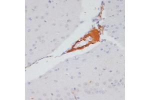 Immunohistochemistry of paraffin-embedded mouse brain using Phospho-ACLY-S455 antibody (ABIN6135178, ABIN6136002, ABIN6136003 and ABIN6225678) at dilution of 1:100 (40x lens). (ACLY 抗体  (pSer455))