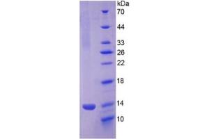 SDS-PAGE (SDS) image for Platelet Factor 4 (PF4) ELISA Kit (ABIN6730927)