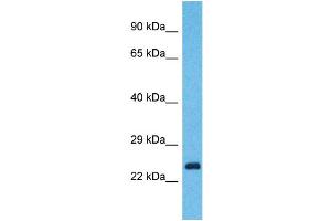 Western Blotting (WB) image for anti-Yip1 Domain Family, Member 7 (YIPF7) (N-Term) antibody (ABIN2791993) (YIPF7 抗体  (N-Term))