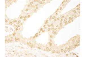 Immunohistochemistry (IHC) image for anti-Integrator Complex Subunit 6 (INTS6) (AA 750-800) antibody (ABIN7448519)