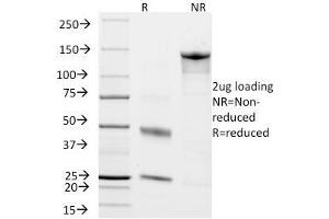 SDS-PAGE Analysis Purified Chromogranin A Monoclonal Antibody (CHGA/798). (Chromogranin A 抗体)