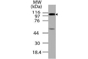 Image no. 1 for anti-Cylindromatosis (Turban Tumor Syndrome) (CYLD) (AA 1-230) antibody (ABIN5027127) (CYLD 抗体  (AA 1-230))