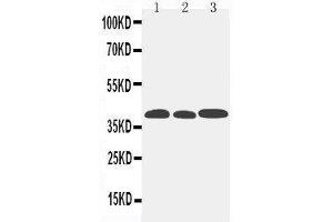 Anti-CCR5 antibody,  Western blotting Lane 1: Mouse Lung Tissue Lysate Lane 2: Mouse Intestine Tissue Lysate Lane 3: Mouse Kidney Tissue Lysate (CCR5 抗体  (N-Term))