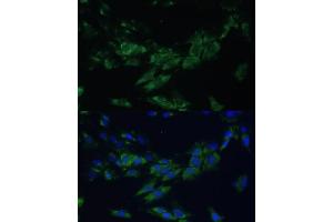 Immunofluorescence analysis of C6 cells using EPH antibody (ABIN6132064, ABIN6140215, ABIN6140216 and ABIN6224369) at dilution of 1:100. (EPH Receptor A4 抗体  (AA 887-986))