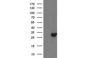 Western Blotting (WB) image for anti-Deoxythymidylate Kinase (Thymidylate Kinase) (DTYMK) antibody (ABIN1497919) (DTYMK 抗体)