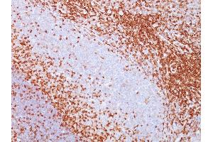 Formalin-fixed, paraffin-embedded human spleen stained with CD43 Mouse Monoclonal Antibody (SPN/839). (CD43 抗体)