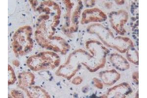 Detection of CPB2 in Human Kidney Tissue using Polyclonal Antibody to Carboxypeptidase B2 (CPB2) (CPB2 抗体  (AA 138-386))