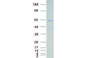 Validation with Western Blot (CAMKK1 Protein (Transcript Variant 3) (Myc-DYKDDDDK Tag))