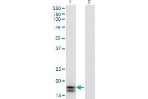 Western Blot analysis of IFNA2 expression in transfected 293T cell line by IFNA2 monoclonal antibody. (IFNA2 抗体  (AA 24-188))
