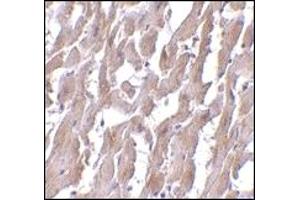 Immunohistochemistry (IHC) image for anti-Myeloid Differentiation Primary Response Gene (88) (MYD88) (AA 176-280) antibody (ABIN492527) (MYD88 抗体  (AA 176-280))