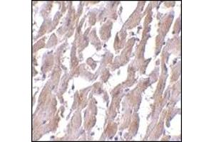 Immunohistochemistry (IHC) image for anti-Myeloid Differentiation Primary Response Gene (88) (MYD88) (AA 176-280) antibody (ABIN492527)