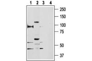 Western Blotting (WB) image for anti-Transient Receptor Potential Cation Channel, Subfamily V, Member 5 (TRPV5) (AA 715-729), (Intracellular) antibody (ABIN7043855)