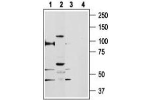 Western blot analysis of rat kidney (lanes 1 and 3) and human PC3 prostate cancer cell line (lanes 2 and 4) lysates: - 1,2. (TRPV5 抗体  (C-Term, Intracellular))
