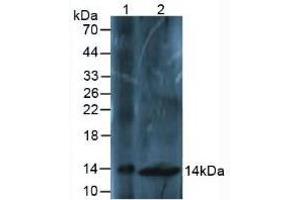 Western blot analysis of (1) Mouse Liver Tissue and (2) Mouse Spinal Cord Tissue. (Osteocalcin 抗体  (AA 14-95))