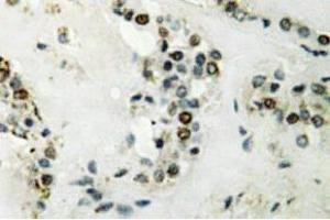 Immunohistochemistry (IHC) analyzes of Cyclin E2 antibody in paraffin-embedded human thyroid gland tissue. (Cyclin E2 抗体)