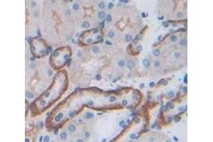 Used in DAB staining on fromalin fixed paraffin- embedded Kidney tissue (JAM3 抗体  (AA 30-241))