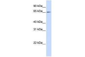 NET1 antibody used at 1 ug/ml to detect target protein. (NET1 抗体  (N-Term))