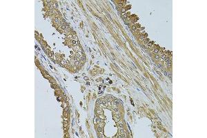 Immunohistochemistry of paraffin-embedded human prostate using MYLIP antibody (ABIN2737207) at dilution of 1:100 (40x lens). (MYLIP 抗体)