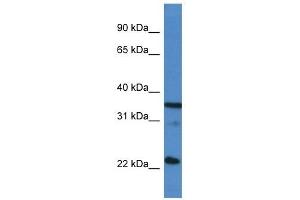 Western Blot showing SFRS2 antibody used at a concentration of 1 ug/ml against Hela Cell Lysate (SRSF2 抗体  (C-Term))