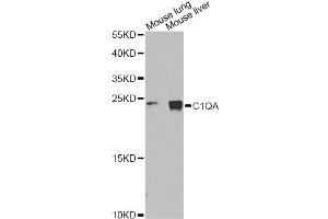 Western blot analysis of extracts of various cell lines, using C1QA Antibody (ABIN1875415) at 1:1000 dilution. (C1QA 抗体)