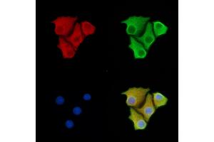 ABIN6263023 and ABIN6277536 staining Hela cells by IF/ICC. (LTBR 抗体  (N-Term))
