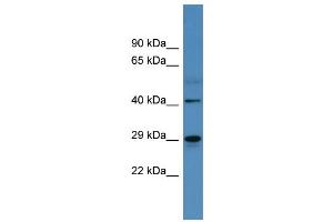 Western Blotting (WB) image for anti-Carbonic Anhydrase II (CA2) (C-Term) antibody (ABIN617259) (CA2 抗体  (C-Term))