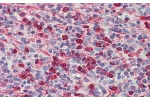 Immunohistochemistry (IHC) image for anti-Phospholipase A2, Group IID (PLA2G2D) (AA 20-134) antibody (ABIN7443731)