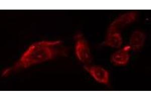 ABIN6279907 staining  Hela cells by IF/ICC. (OTUB1 抗体  (Internal Region))