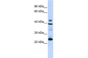 WB Suggested Anti-SEPP1 Antibody Titration: 0. (Selenoprotein P 抗体  (N-Term))