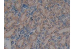DAB staining on IHC-P; Samples: Rat Kidney Tissue (GALNS 抗体  (AA 172-381))