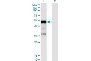 Western Blot analysis of TARBP2 expression in transfected 293T cell line by TARBP2 monoclonal antibody (M03), clone 1D9. (TARBP2 抗体  (AA 141-250))