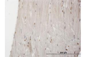 Immunoperoxidase of monoclonal antibody to MEF2BNB on formalin-fixed paraffin-embedded human skeletal muscle. (MEF2BNB 抗体  (AA 1-109))