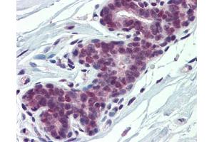 Immunohistochemistry (IHC) image for anti-Poly(rC) Binding Protein 1 (PCBP1) (Middle Region) antibody (ABIN2778971) (PCBP1 抗体  (Middle Region))